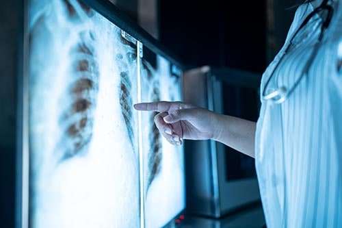 X-Rays X-Rays